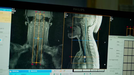 close up of ct scan. several ct computer tomography scan images