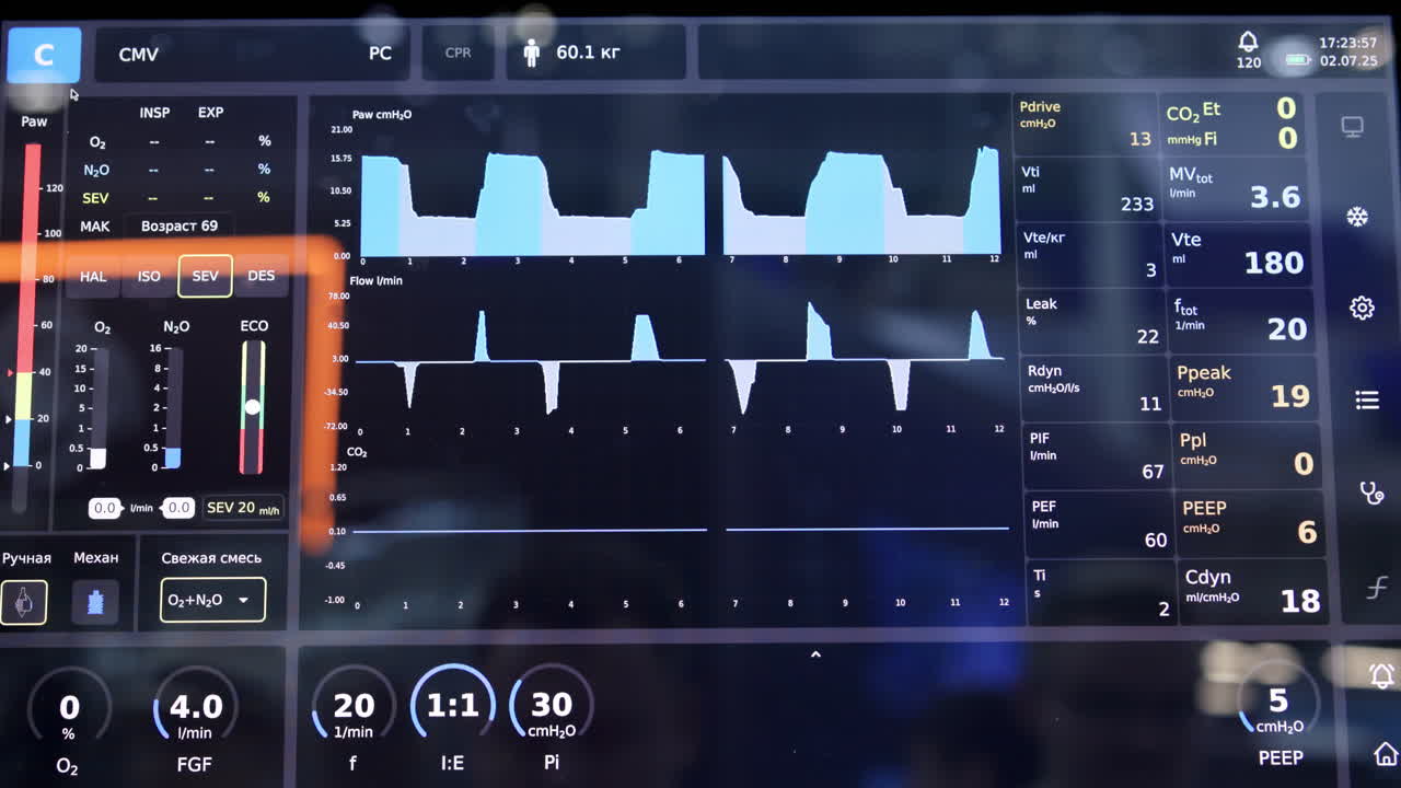 Medical Ventilator or Anesthesia Machine Screen Displaying Patient Parameters