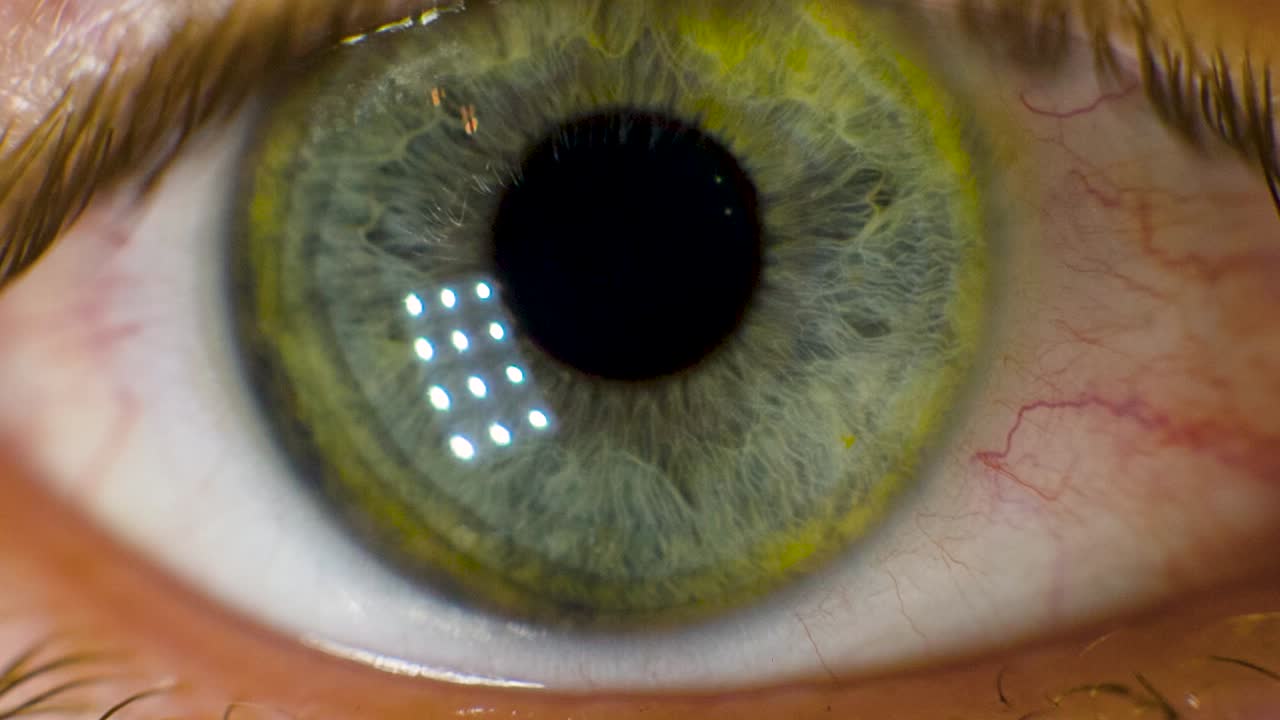 인간 눈의 클로즈업