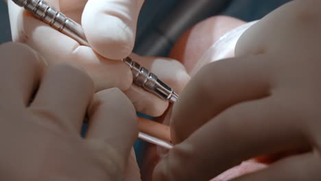 procedimiento dental