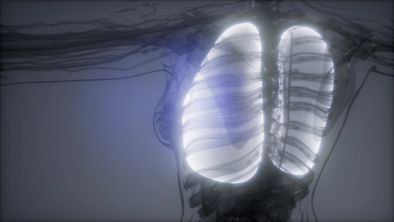 인간의 폐 방사선 검사