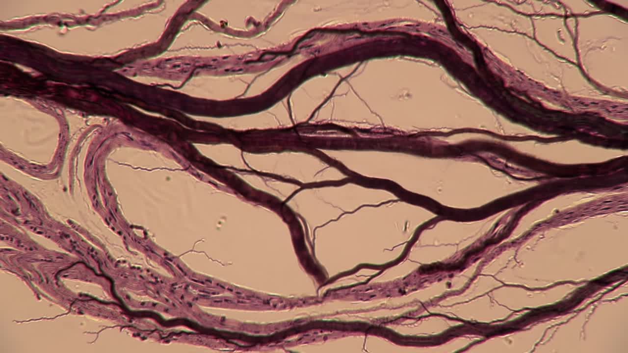 Microscopic Examination of Complex Vascular Structures Showcasing Intricate Patterns and Variations in a Biological Sample Under High Magnification