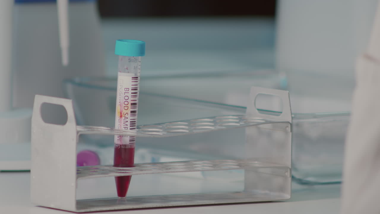 Placing test tube with blood sample into holder, laboratory closeup of hand in rubber glove
