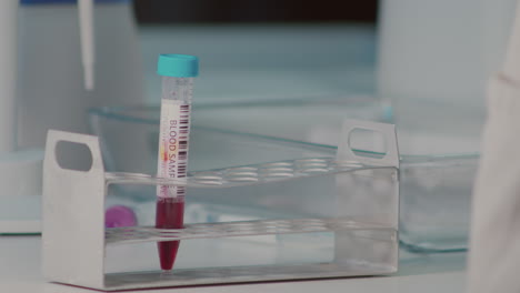placing test tube with blood sample into holder, laboratory closeup of hand in rubber glove