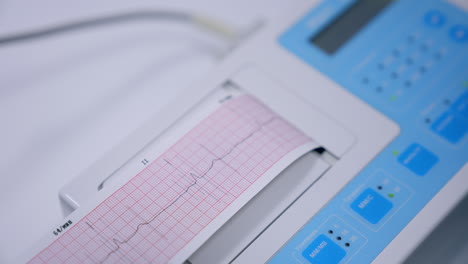 electrocardiogram check up in clinics. electrocardiograph machine giving the paper with heart beat curve line. close up.