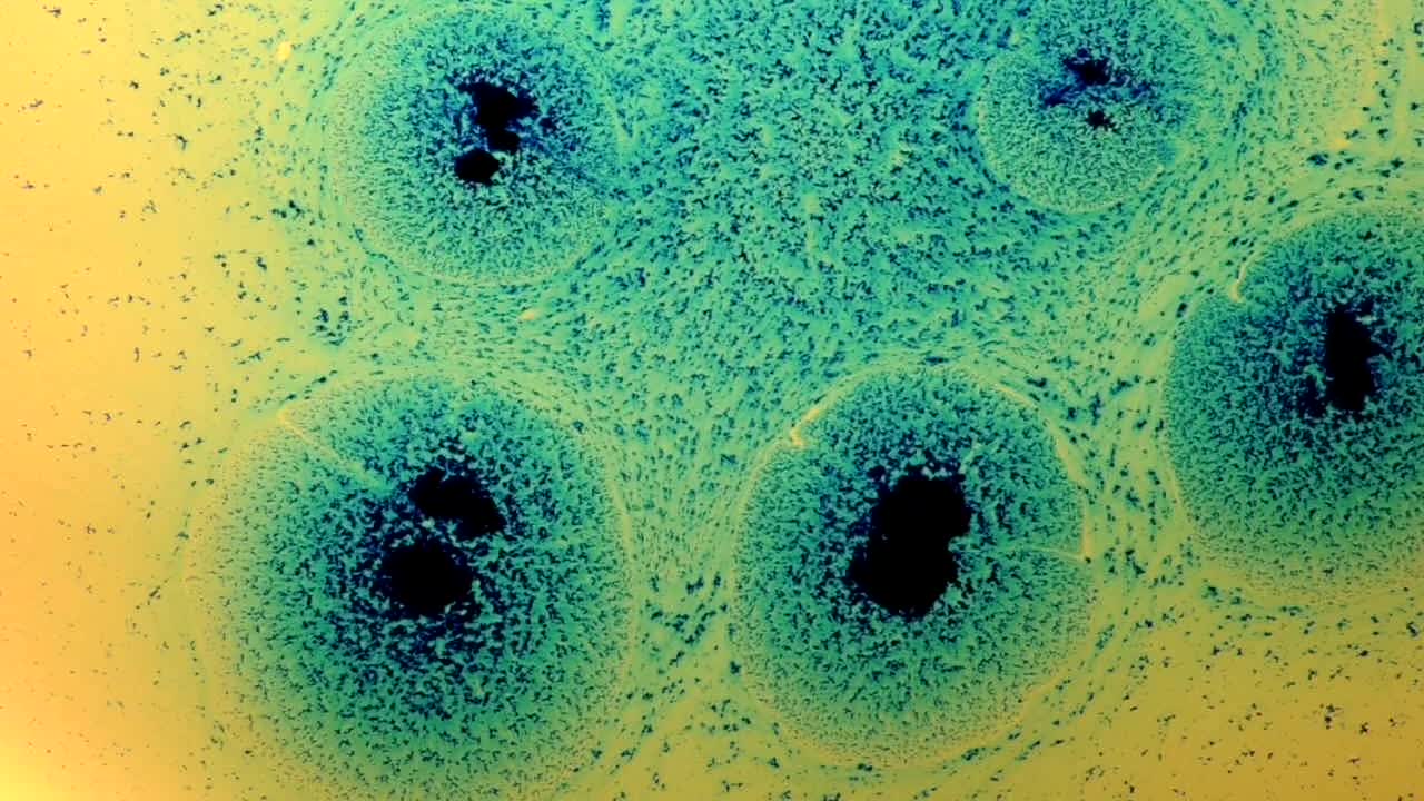 los poros se ensanchan y se abren y emergen maravillas granulares azules; para obtener más información, busque "videoclip abstracto" entre comillas