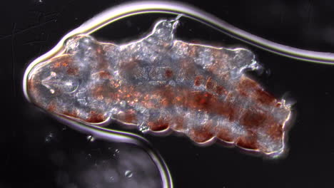 microscopic view of a tardigrade (water bear)