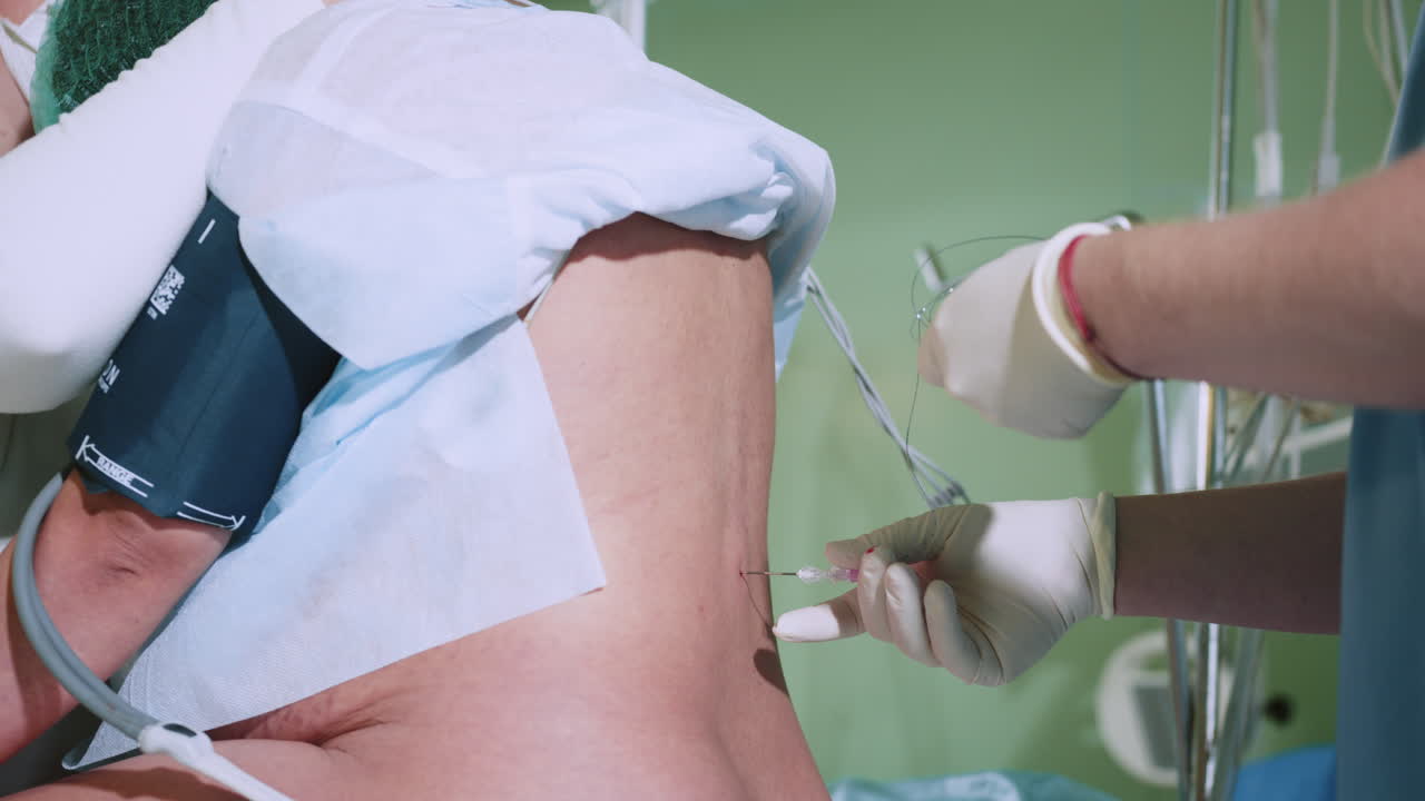 procedimiento de inyección epidural