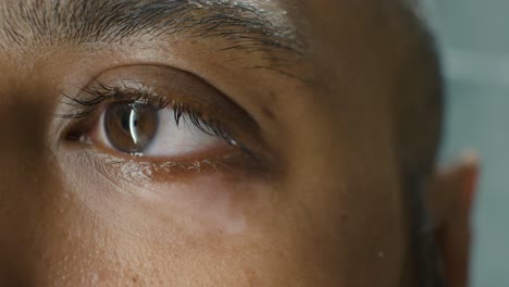 primer plano de vitíligo en el párpado del hombre del sudeste indio