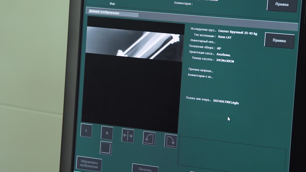 Doctor looking at an x-ray in a hospital