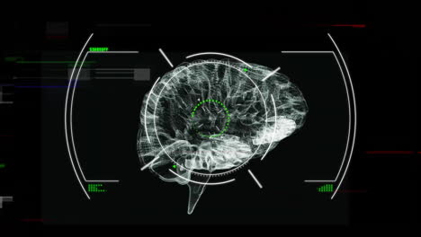 animation of scope and data processing over human brain