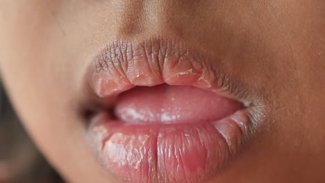 close up of baby dry lip