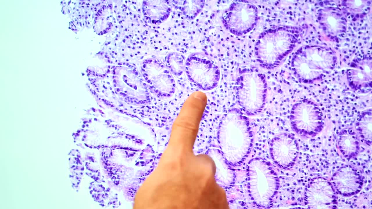 Histological Image Analysis