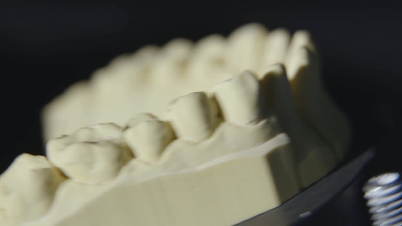Dental Mold being Scanned for 3D software.