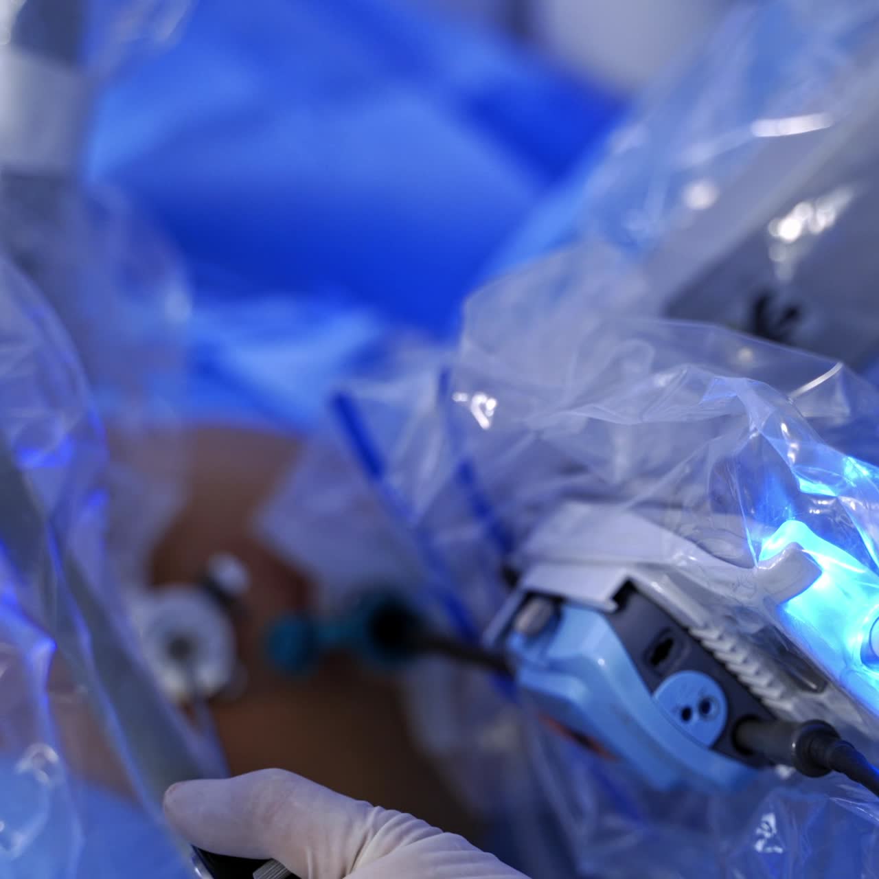 Robotic arms doing a surgery. Doctor's hands in sterile gloves use modern medical equipment in the surgery room. Minimally invasive robotic operation. Close-up.