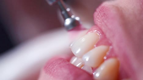 procedimiento dental