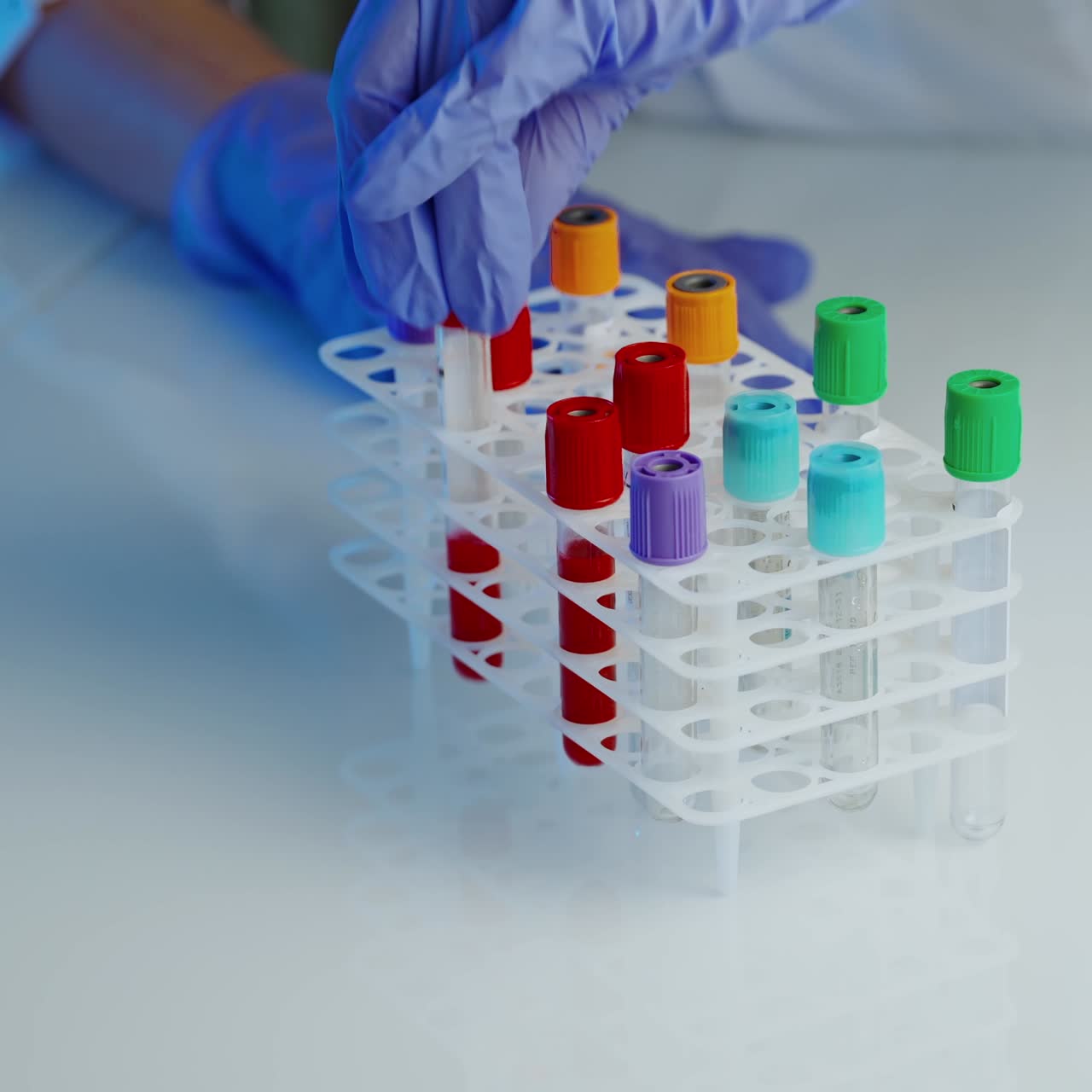 Test tubes with blood samples