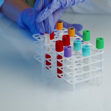 test tubes with blood samples