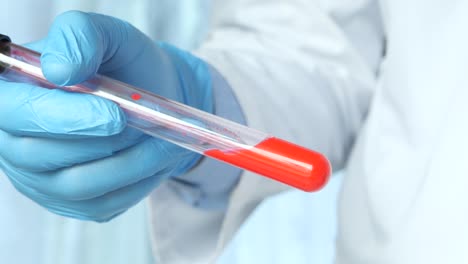 técnico de laboratorio sosteniendo un tubo de ensayo con líquido rojo