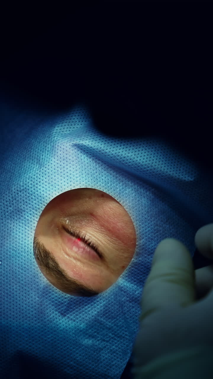 Modern medical laser eye correction. New healthcare cataract surgery. Vertical video