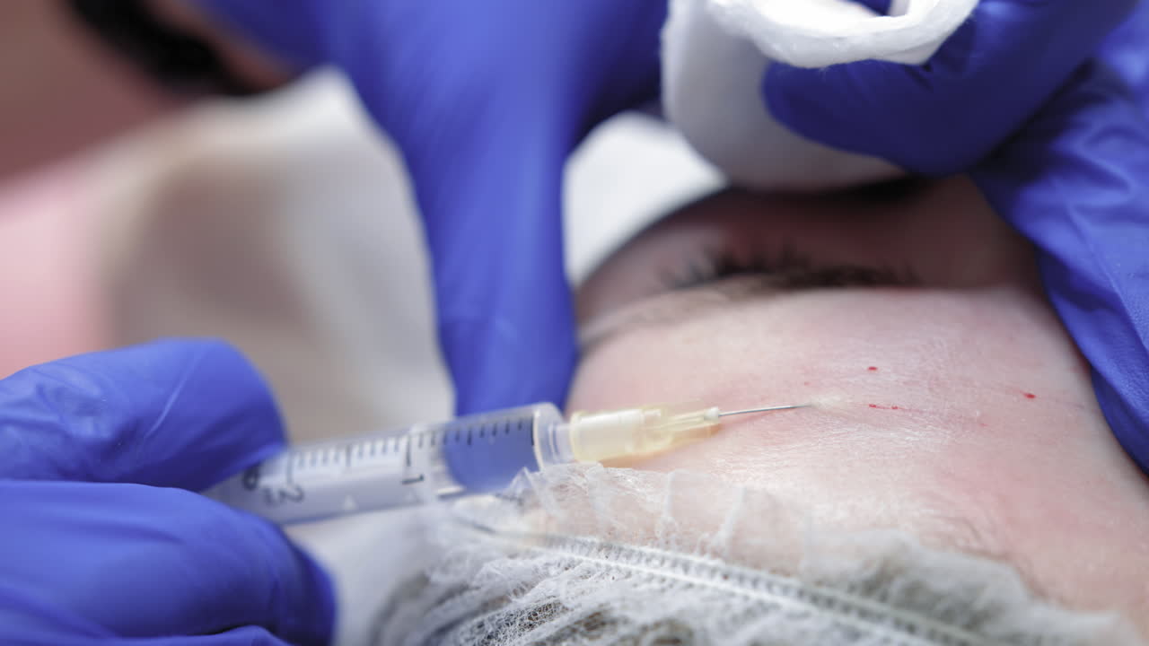 procedimiento de inyección facial