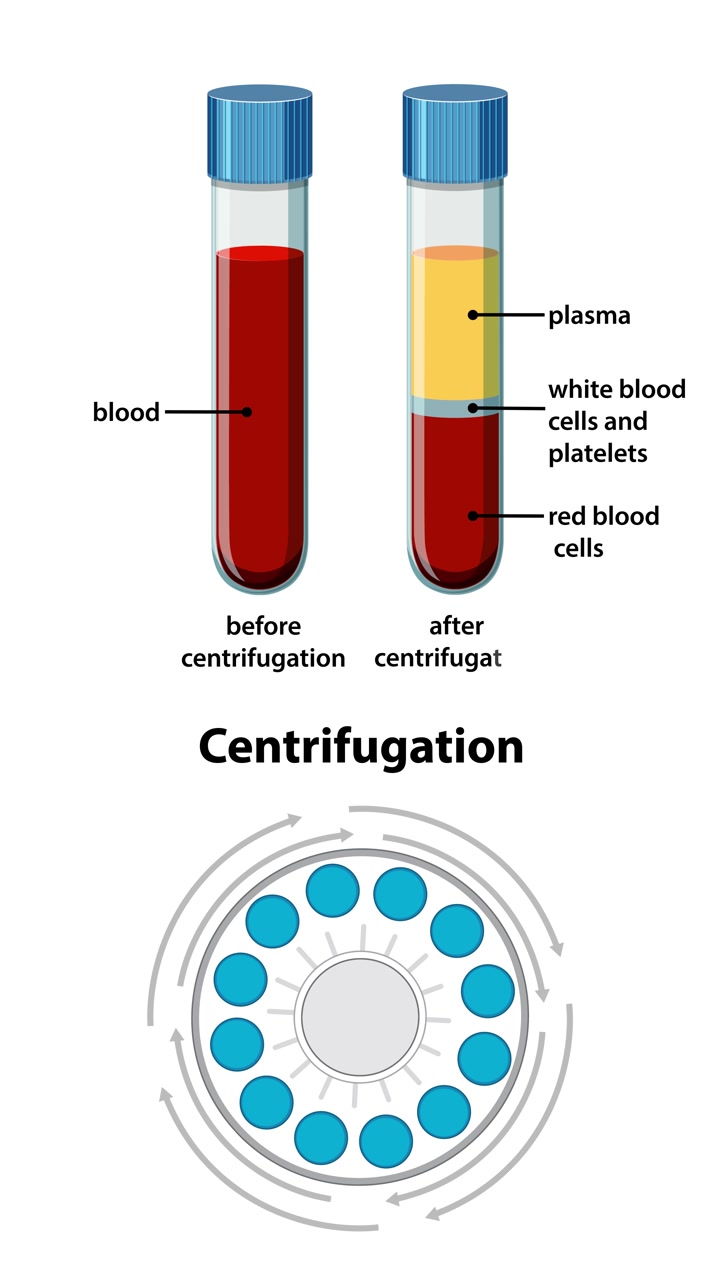 Vertical medical graphic showing blood separating into plasma, white cells, and red cells via centrifugation.
