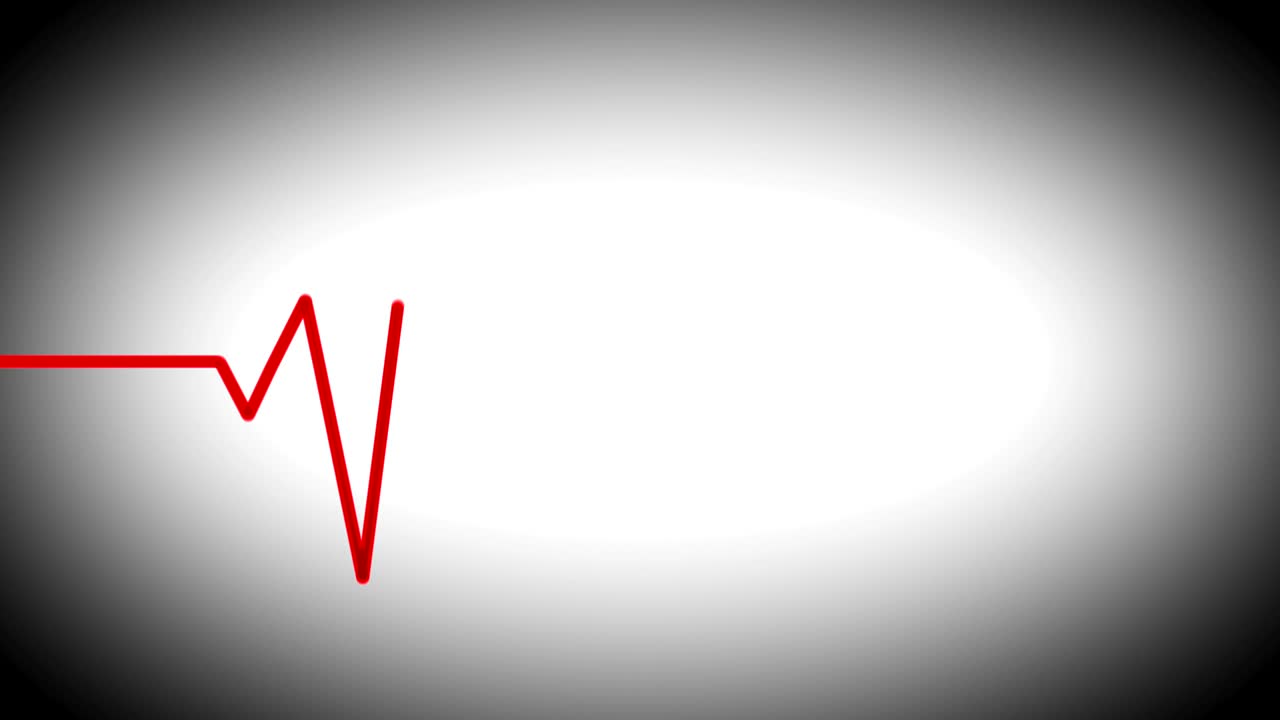 심장전도 (ecg) 루프 빨간색