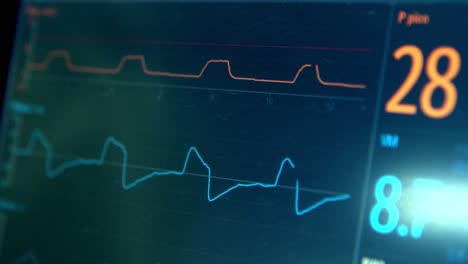 a monitor tracks the vital signs of a hospital patient with covid-19 p1 brazilian variant