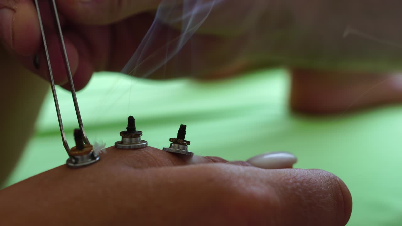 건강 센터에서 moxibustion 절차를 수행하는 치료사: moxibustion은 인체의 전체 표면에 위치한 생물학적으로 활동적인 지점에 대한 열 효과입니다.