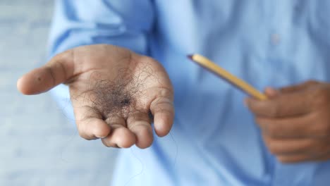 hair loss in hand