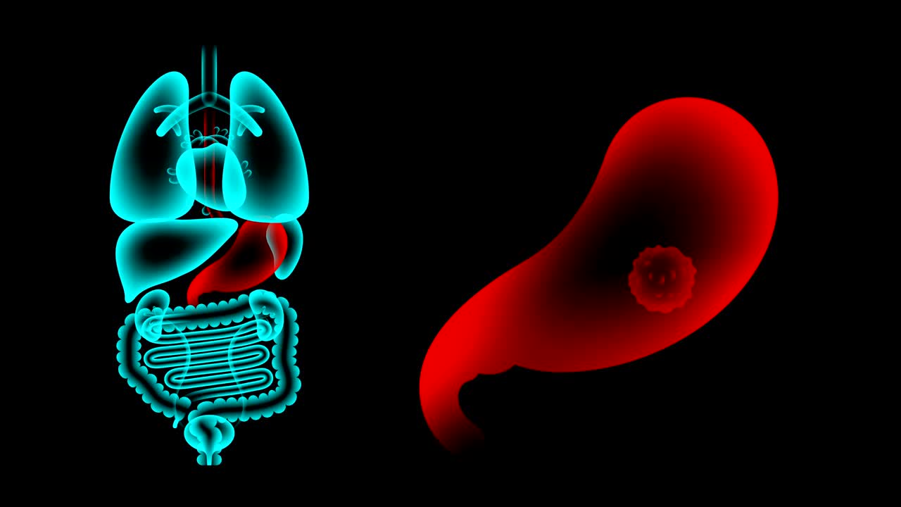 conjunto de rayos x de órganos masculinos, infección estomacal concepto idea ilustración de color rojo brillo aislado en el fondo oscuro, animación de bucle sin costuras 4k con espacio de copia