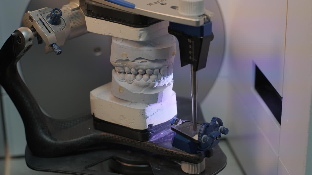 escáner dental 3d que captura el modelo de prótesis de arco completo