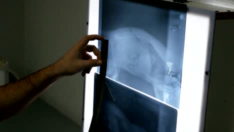 doctor measures the proportions of bones using a ruler on an x-ray photograph