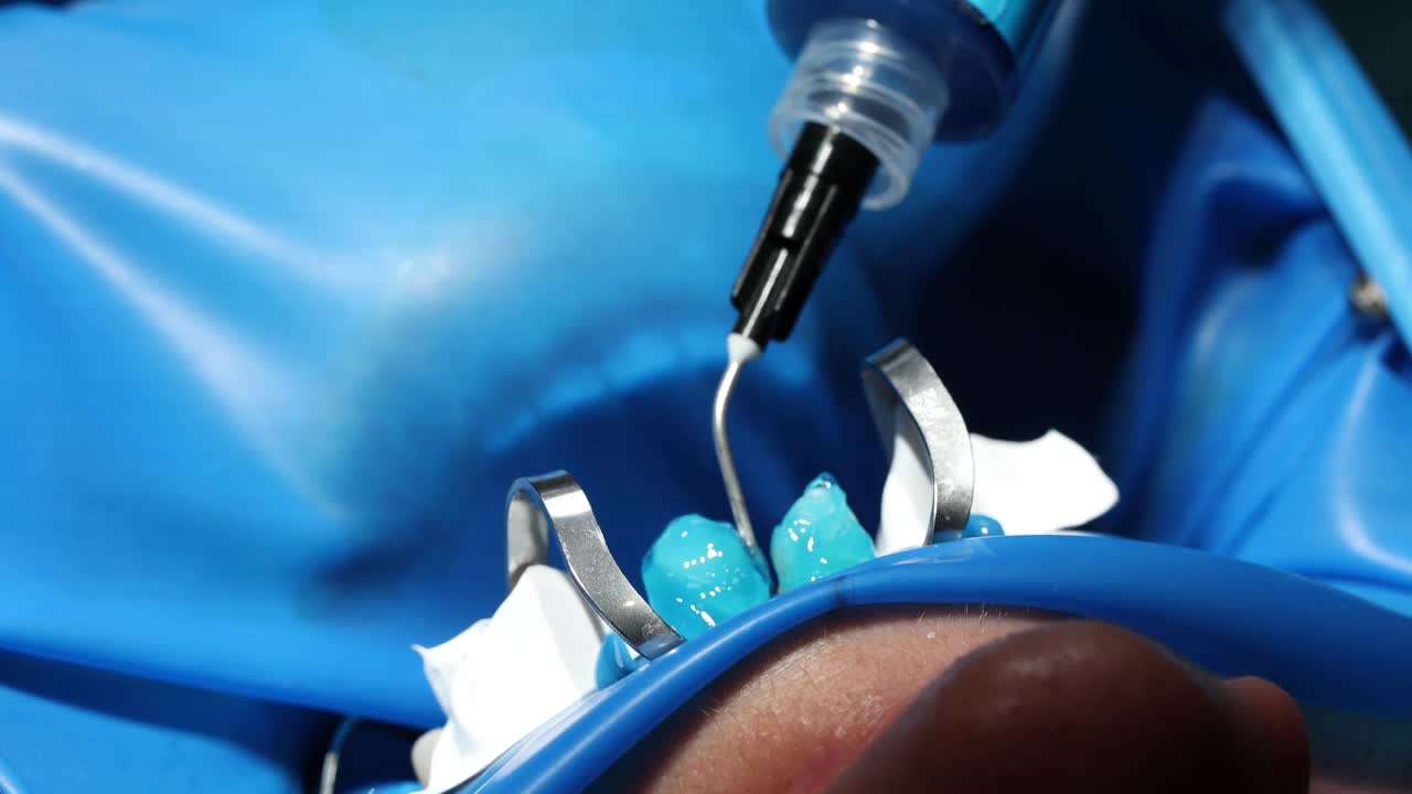 Close-up of a dental procedure with a dental dam and instruments