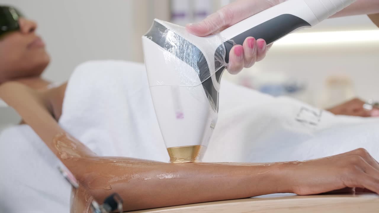 미용실에서 레이저 제거 및 화장품. 화장품, 스파 및 탈모 개념. 여성 다리의 레이저 탈모 절차. 장갑을 입은 의사.