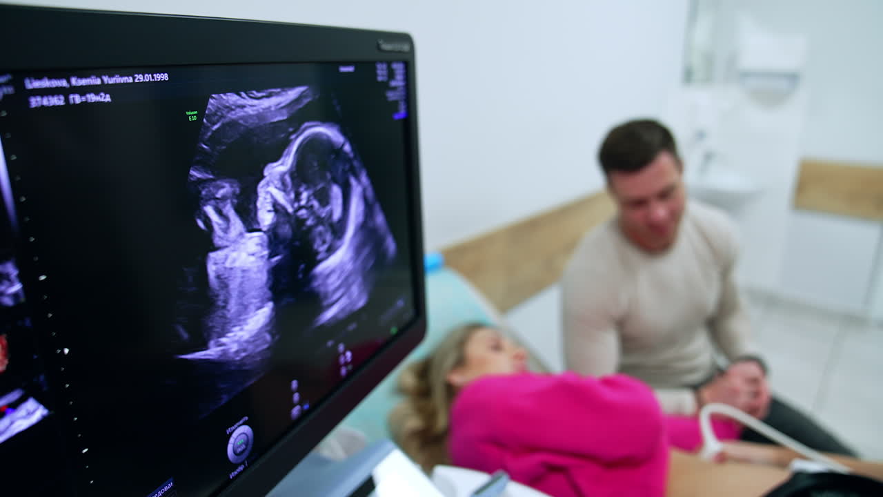 Baby ultrasound scan on the machine screen. Married couple at backdrop. Pregnancy examination and observing in clinics.
