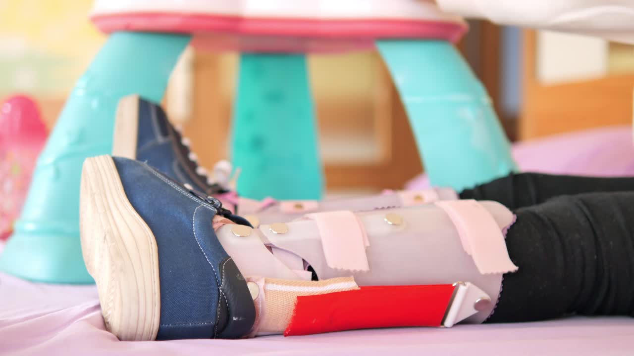 아이의 다리는 정형외과 브레이크에 달려 있습니다.