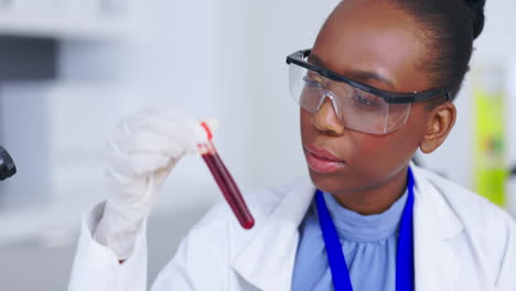 Blood-test,-science-and-black-woman-with-research