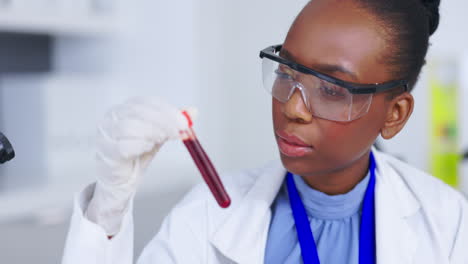 blood test, science and black woman with research