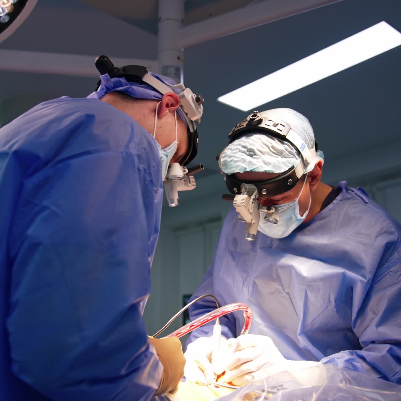 Medici con occhiali per dispositivi applicano strumenti moderni durante un intervento di neurochirurgia. Vista dal basso. Un'infermiera assiste i chirurghi.