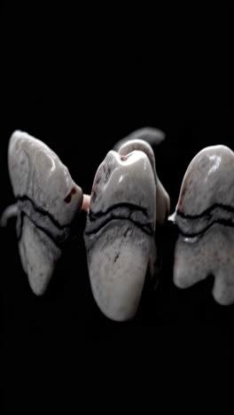 close-up of damaged teeth model