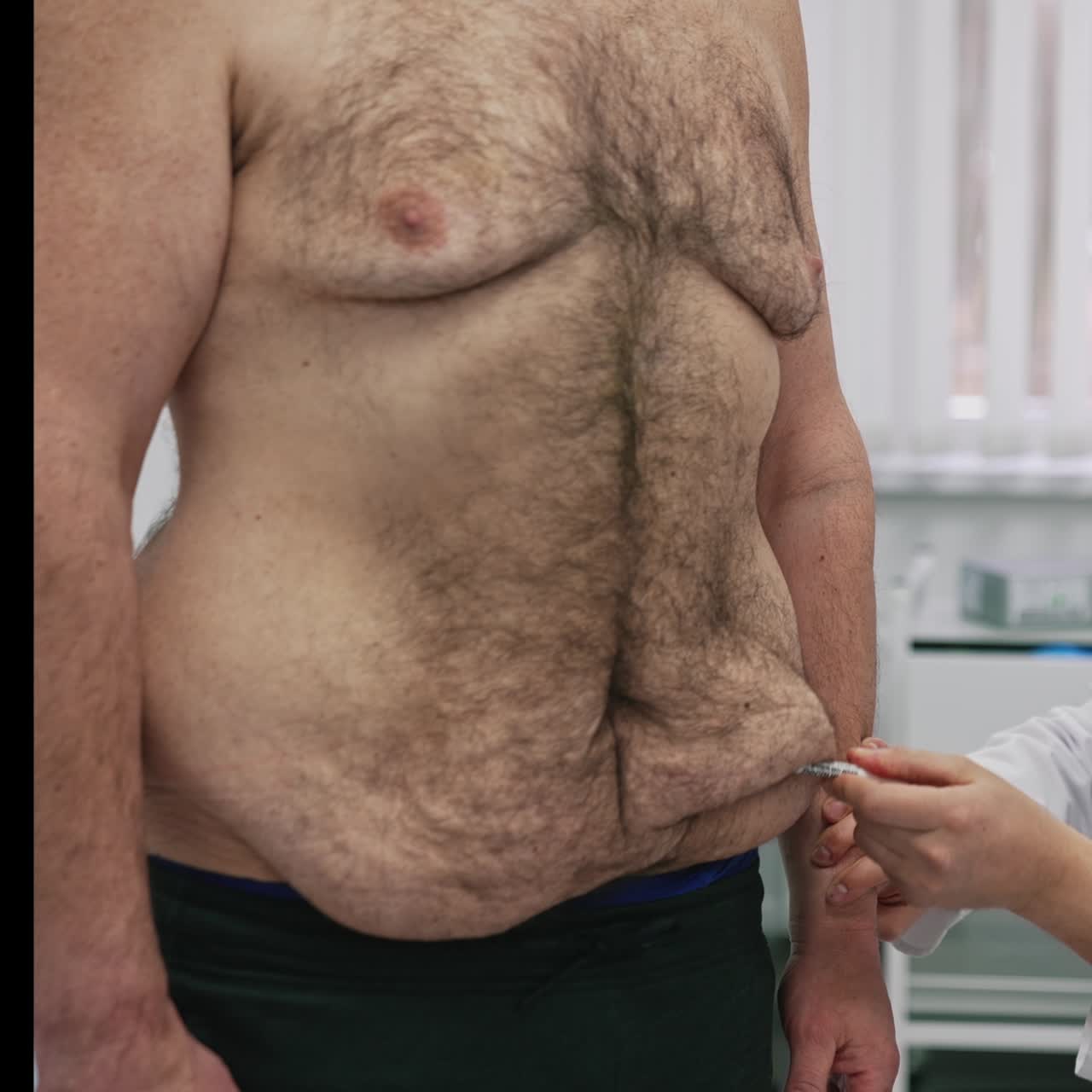 Plastic doctor shows the abdominal of an overweight patient. Surgeon speaks about problem parts on a belly of a patient man. The result of weight loss