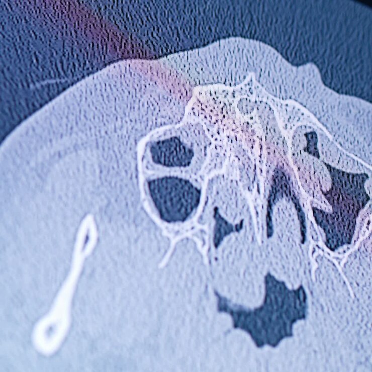 MRI image of patient's head. Close up. Analyzing the nasal cavity on the monitor of equipment