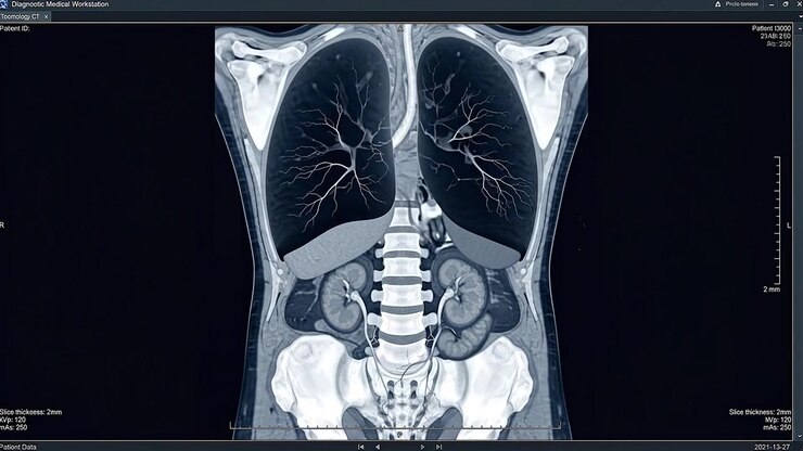 Coronal View CT Scan of Human Torso