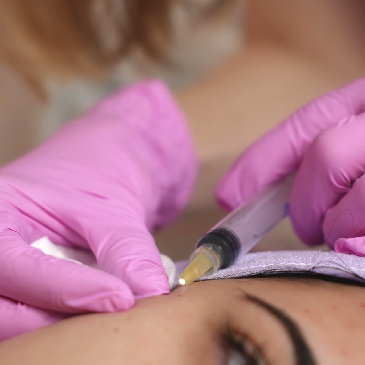 Hands of cosmetologist making injection in face. Aesthetic cosmetology.