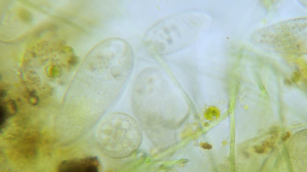 현미경 밝은 분야에서 paramecium 고밀도 인구