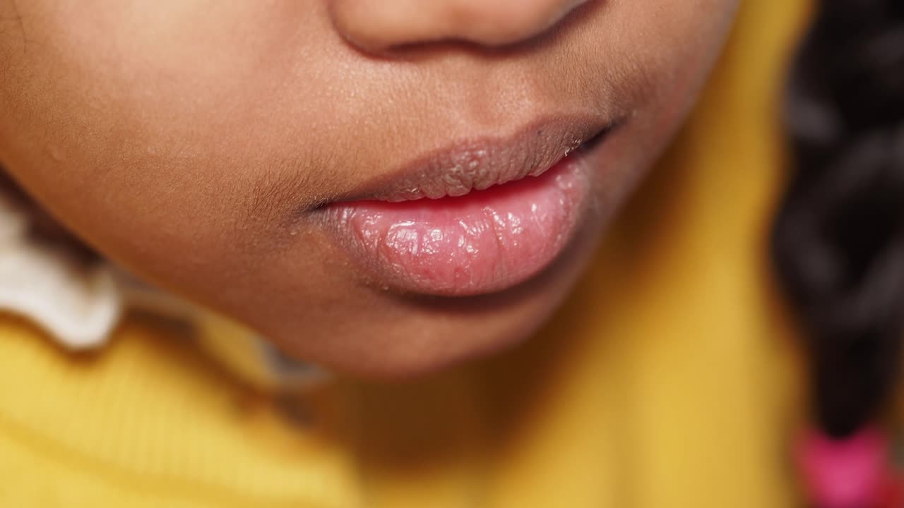 Close up of a child's mouth and lips