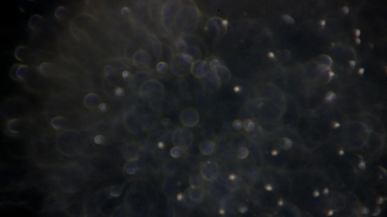 초점 조정이 있는 고배율의 정자 세포