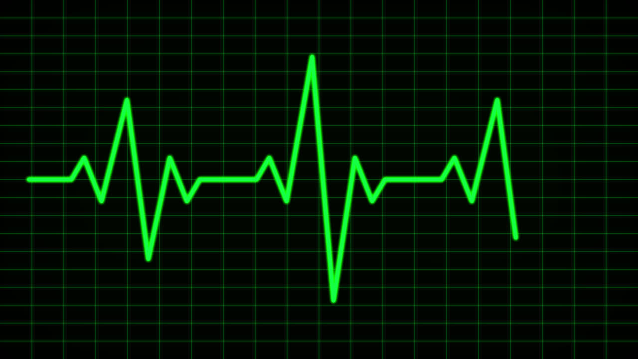 Monitor de frecuencia cardíaca ECG verde mostrando el pulso en cuadrícula