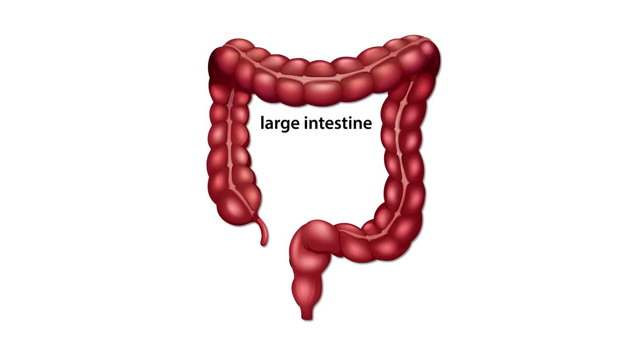 Illustration of colon cancer development, lymph node involvement, and liver metastasis in a detailed medical animation
